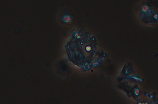 Macchie bianche su nocciolo (Exidiopsis calcea)